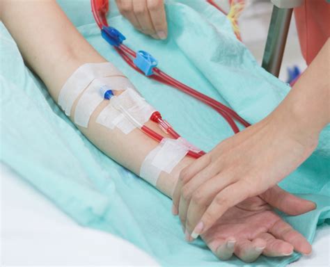 Mengenal Cara Kerja Mesin Cuci Darah Hemodialisis Kli Vrogue Co
