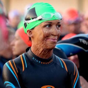 Everything To Live For Book Turia Pitt