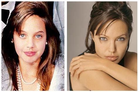 Plastic Surgery Before And After Angelina Jolie Plastic Surgery