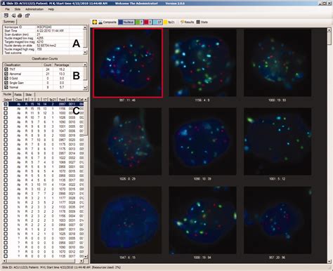 Digitized Microscopy In The Diagnosis Of Bladder Cancer Marganski Cancer