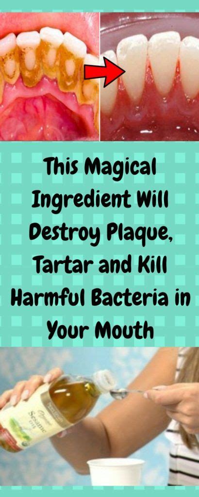 This Magical Ingredient Will Destroy Plaque Tartar And Kill Harmful