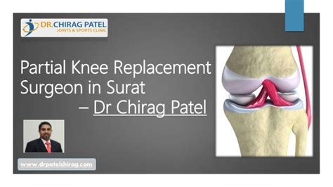 Partial Knee Replacement Surgeon In Surat Dr Chirag Patel