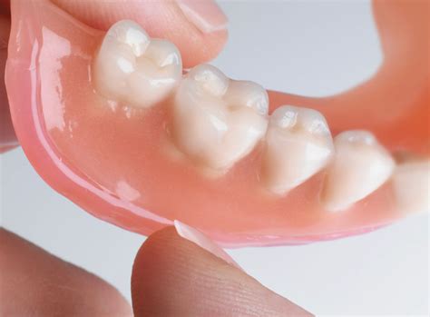 What Is A Denture Soft Reline