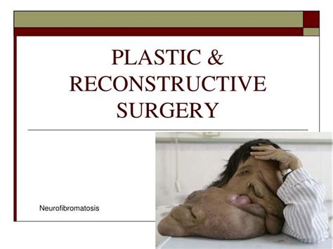 Ppt Plastic And Reconstructive Surgery Powerpoint Presentation Free