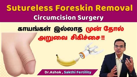 காயங்கள் இல்லாத முன்தோல் அறுவைசிகிச்சை Sutureless Foreskin Removal Circumcision Surgery Dr
