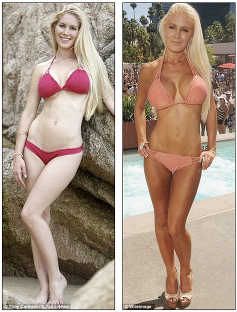 Heidi Montag Plastic Surgery Before And After Photos