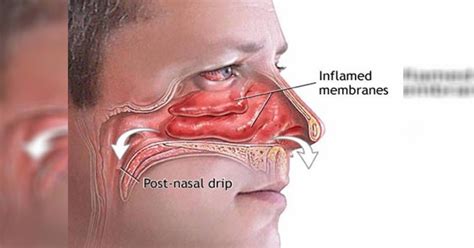1 Simple Trick That Will Clear Your Clogged Sinuses In A Few Seconds Useful Tips For Home