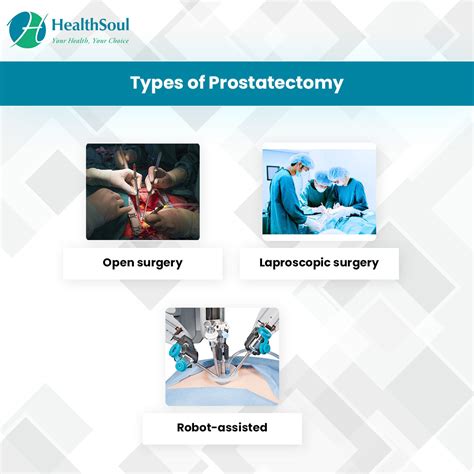 Types Of Prostate Surgery Procedures