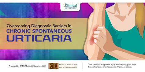 Overcoming Diagnostic Barriers In Chronic Spontaneous Urticaria Rmei