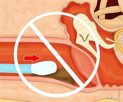 There are a few things that can happen if. How to Get Rid of Earwax | Ear cleaning wax, Ear wax, Ear ...