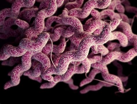 Campylobacteriosis Causes Symptoms Diagnosis And Treatment