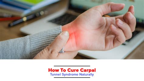 How To Cure Carpal Tunnel Syndrome Naturally Bioflex Pakistan