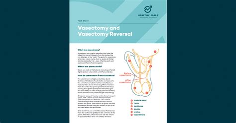 vasectomy healthy male