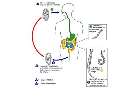 Oxiuros infección intestinal por parásitos CuídateCV