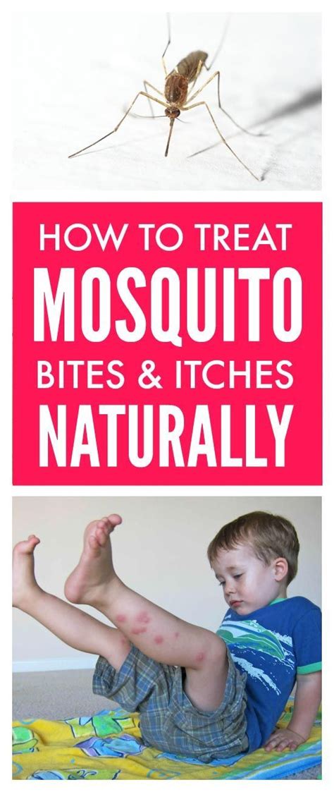 Treat Mosquito Bites Naturally With Images Remedies For Mosquito Bites Mosquito Bite