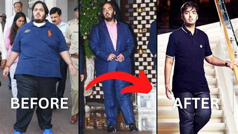 Anant Ambani Weight Loss Journey 108kg The Unbelievable Weight Loss