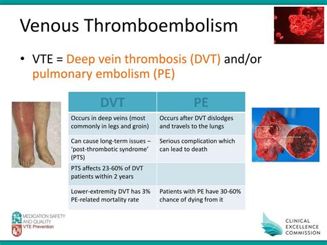 Ppt Hospital Acquired Venous Thromboembolism Powerpoint Presentation 28f
