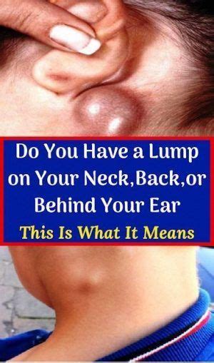 Do You Have A Lump On Your Neck Or Behind Your Ear What It Means And How