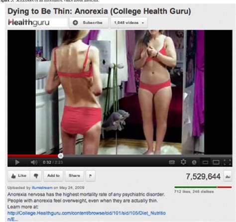 Anorexia Before And After Treatment