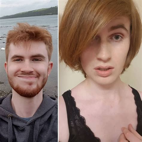 Mtf Hrt Body Before And After Photos