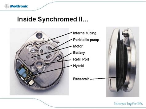 Synchromed Ii Programmable Implantable Drug Pump Medtronic Neuromodulation