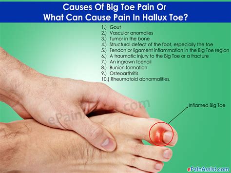 Big Toe Pain Know What Can Cause Pain In Hallux Toe And Its Treatment
