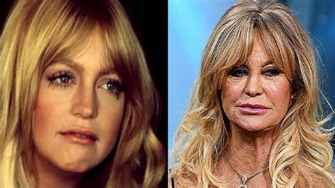 Prayers 75 Year Old Goldie Hawn Begs For The Help As She Is Fighting