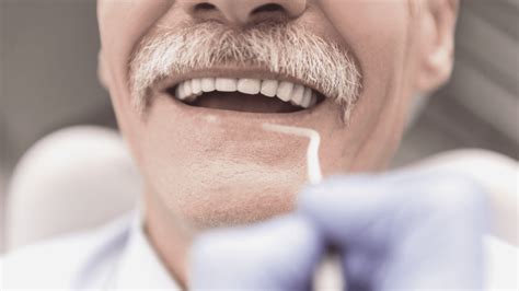 ¿qué Es El Curetaje Dental Clínica Dental Pcm · Clínica Dental En