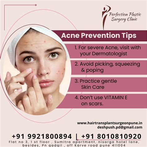 Acne Prevention Tips Book An Appointment Call 91 9921800894 Call