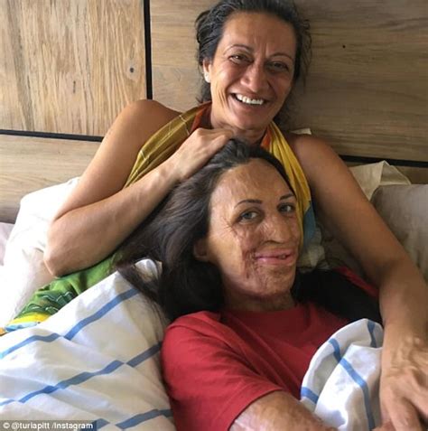 Turia Pitt S Mum Had Her Books Rejected By A Publisher Daily Mail Online
