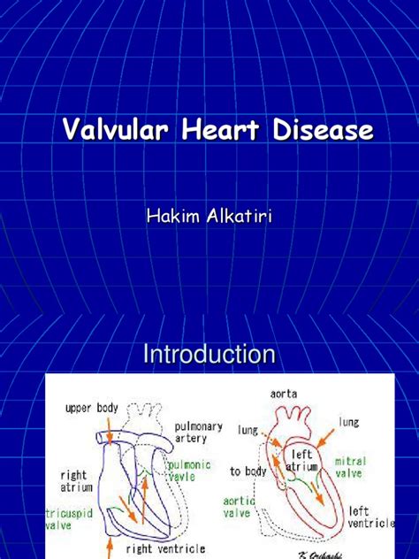 Valvular Heart Diseaseppt Heart Failure Internal Medicine