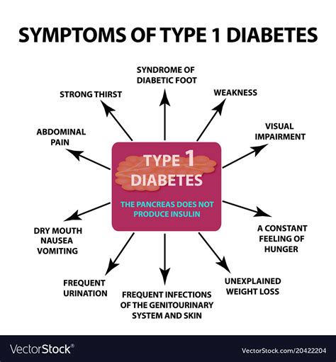 Symptoms type 1 diabetes infographics Royalty Free Vector