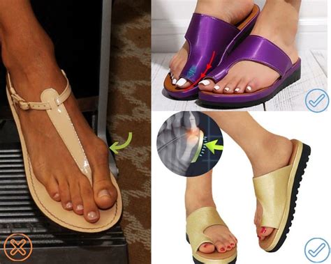 Bunionfree Bunion Correction Sandals In 2020 Women Platform Sandals