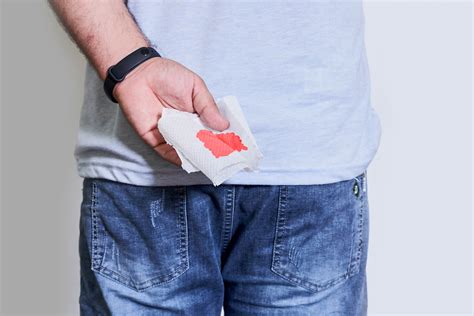 Young Male Hand Holds A Piece Of Toilet Paper With Blood From