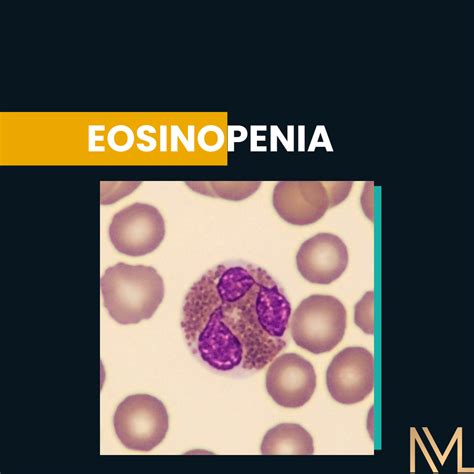 Eosinopenia Causas Sintomas E Tratamento Inml