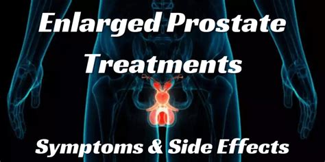 Enlarged Prostate Treatment Options Symptoms Side Effects