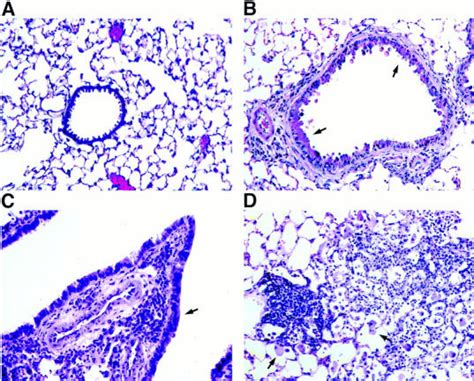 Parenchymal simply means in the lung tissue. malignant lesions could be primary or secondary.primary means cancer arising from lung parenchyma itself. Lung histology of conducting airways and parenchyma ...
