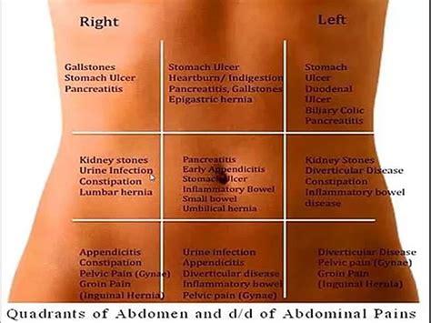 Differential Diagnosis Of Abdominal Pain According To Abdominal Regions