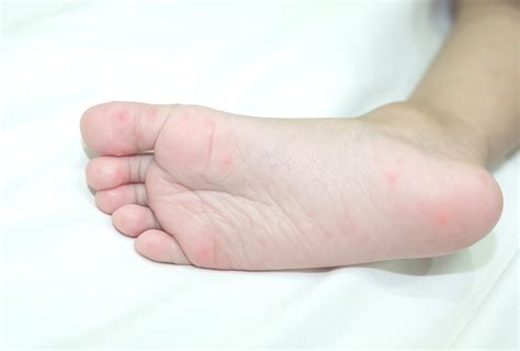 Various Foot Problems That Can Raise Your Concern Towards Your Feet