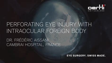 Surgery Video Perforating Eye Injury With Intraocular Foreign Body By