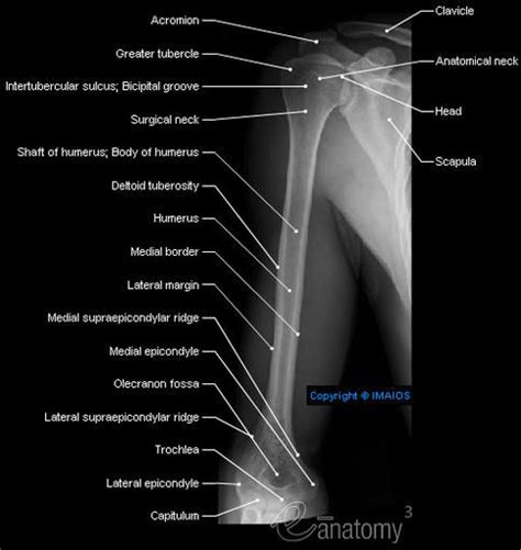 Radiography Arm Humerus Shaft Of Humerus Body Of Humerus Surgical Neck Medial