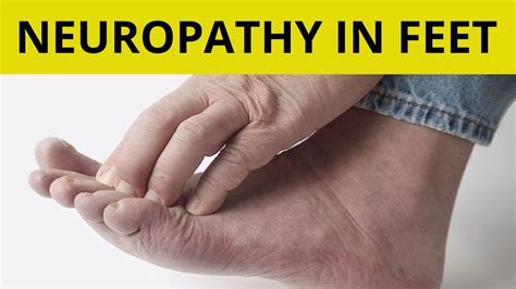 Peripheral Neuropathy Treatment 9 Tips On How To Handle Neuropathy In