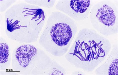 Mitosis Stages Of Mitosis Teachmephysiology