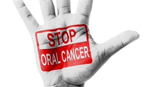 The Details Of Oral Cancer Screening Directorio Odontológico