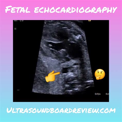 Fetal Echocardiography Review Ardms What Is The Hand Pointing To A