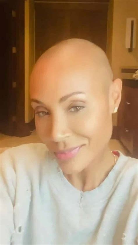 Jada Pinkett Smith Shares Hair Loss Update Due To Alopecia