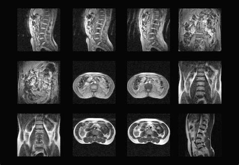 Premium Photo Dorsal Spine Mri And Ct Scan Professional Xray Images