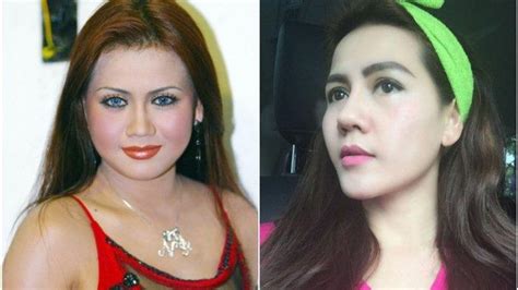 Wajah Artis Sebelum Dan Sesudah Operasi