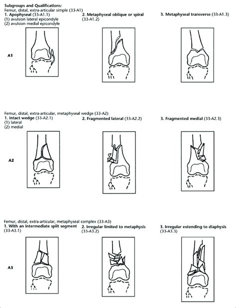 AO OTA Classification Of Distal Femur Type A Fractures Download Scientific Diagram