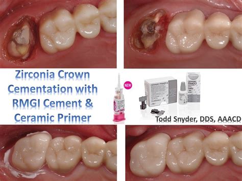Todd C Snyder, DDS (@TCSAesthetics) | Dental design, Dds, Dental